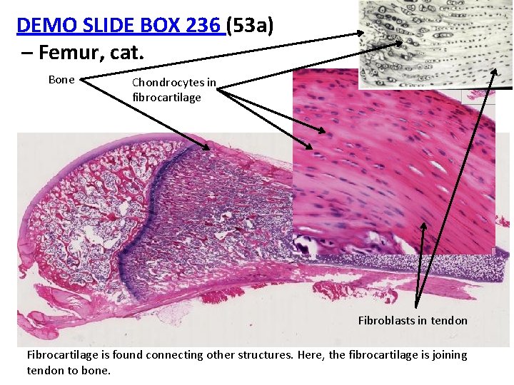 DEMO SLIDE BOX 236 (53 a) – Femur, cat. Bone Chondrocytes in fibrocartilage Fibroblasts