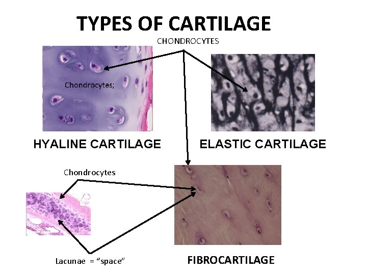 TYPES OF CARTILAGE CHONDROCYTES HYALINE CARTILAGE ELASTIC CARTILAGE Chondrocytes Lacunae = “space” FIBROCARTILAGE 