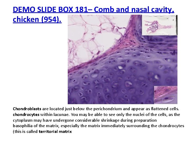 DEMO SLIDE BOX 181– Comb and nasal cavity, chicken (954). Chondroblasts are located just