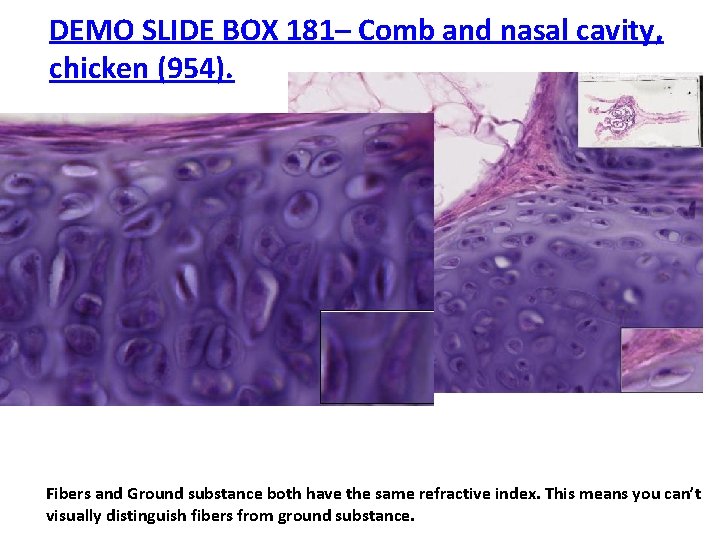 DEMO SLIDE BOX 181– Comb and nasal cavity, chicken (954). Fibers and Ground substance