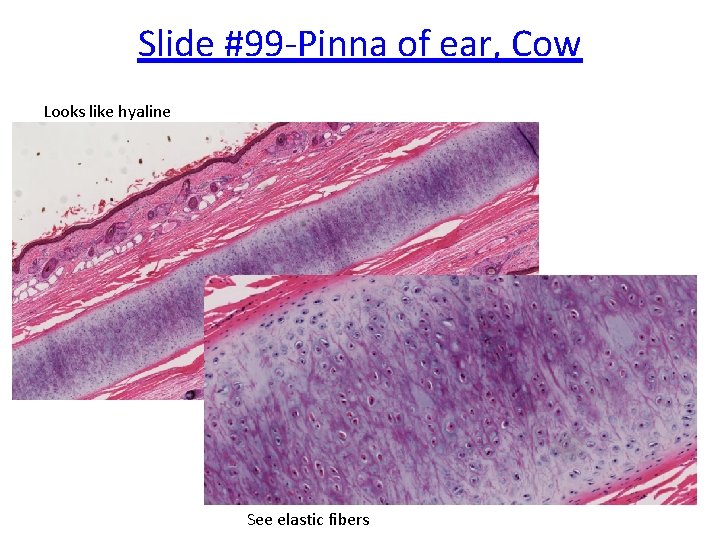 Slide #99 -Pinna of ear, Cow Looks like hyaline See elastic fibers 