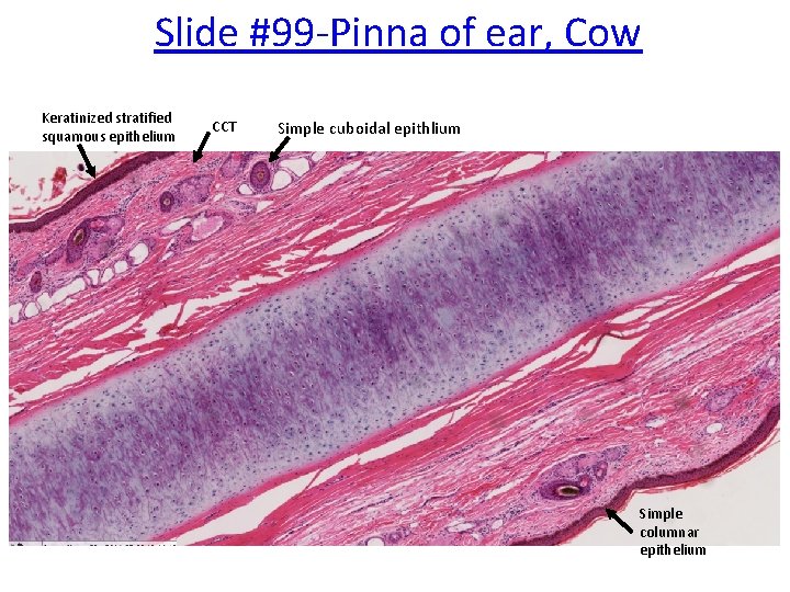 Slide #99 -Pinna of ear, Cow Keratinized stratified squamous epithelium CCT Simple cuboidal epithlium