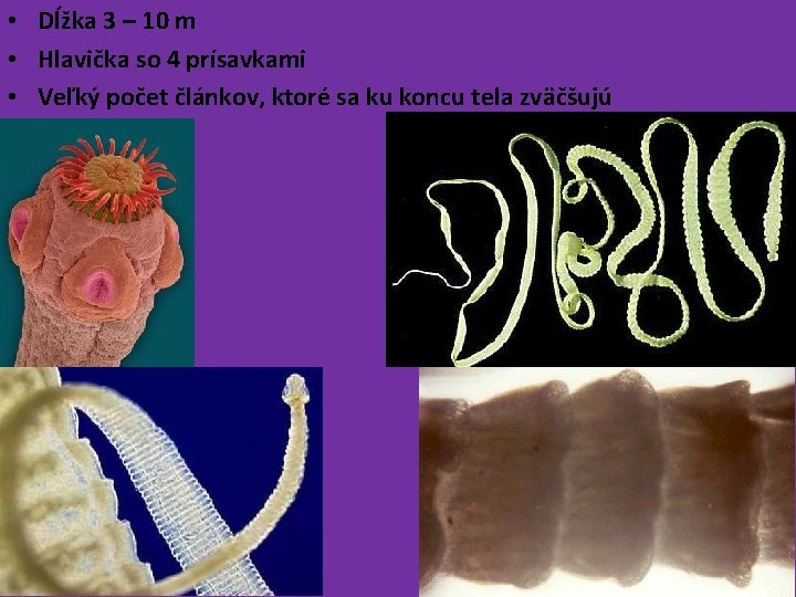  • Dĺžka 3 – 10 m • Hlavička so 4 prísavkami • Veľký