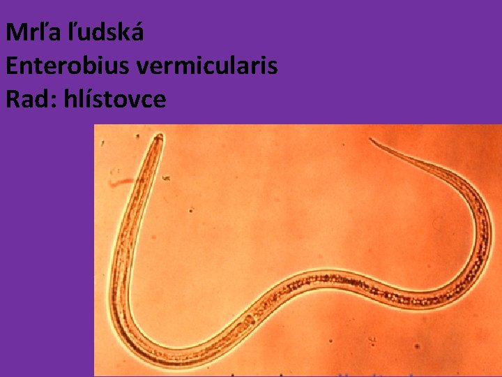 Mrľa ľudská Enterobius vermicularis Rad: hlístovce 