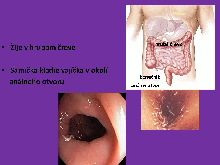  • Žije v hrubom čreve • Samička kladie vajíčka v okolí análneho otvoru