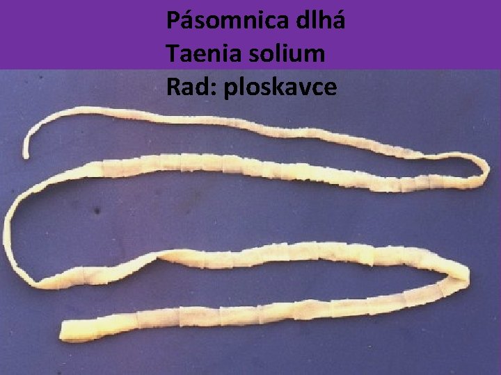 Pásomnica dlhá Taenia solium Rad: ploskavce 