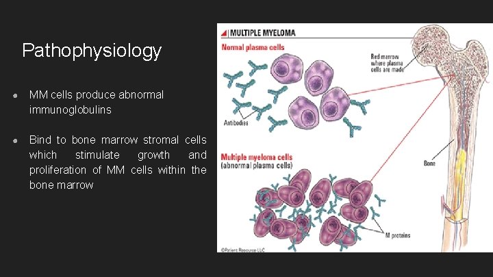 Pathophysiology ● MM cells produce abnormal immunoglobulins ● Bind to bone marrow stromal cells