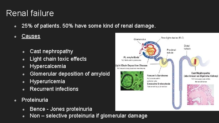 Renal failure ● 25% of patients. 50% have some kind of renal damage. ●