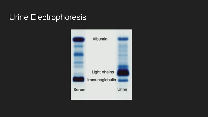 Urine Electrophoresis 