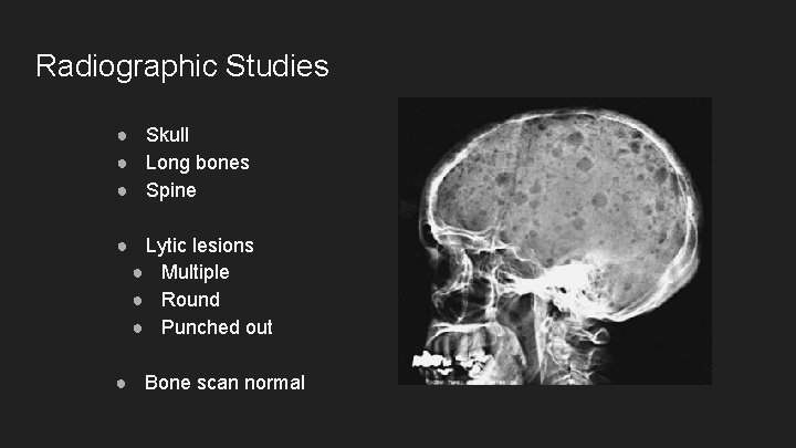 Radiographic Studies ● Skull ● Long bones ● Spine ● Lytic lesions ● Multiple