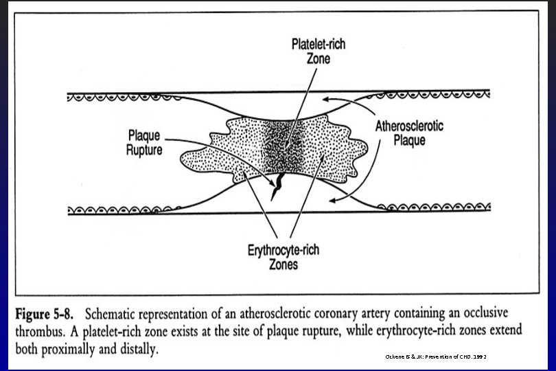 Ockene IS & JK: Prevention of CHD. 1992 