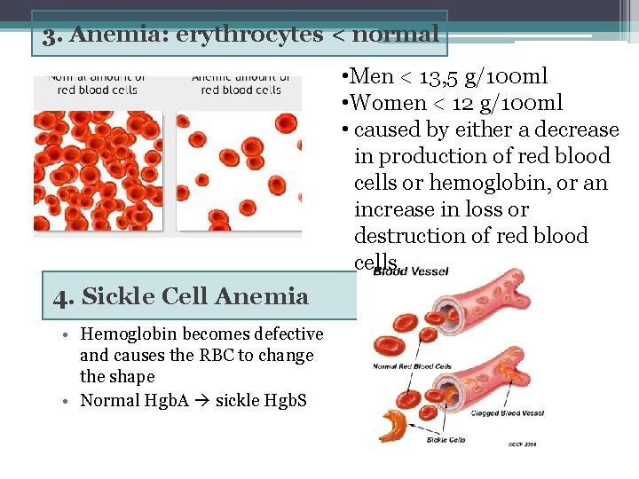 3. Anemia: erythrocytes < normal • Men < 13, 5 g/100 ml • Women