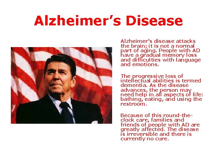 Alzheimer’s Disease Alzheimer's disease attacks the brain; it is not a normal part of