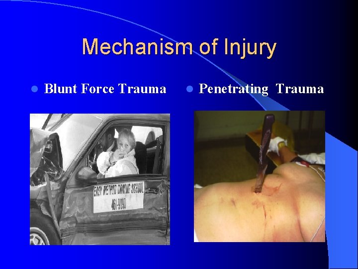 Mechanism of Injury l Blunt Force Trauma l Penetrating Trauma Mechanism of Injury l Blunt Force Trauma l Penetrating Trauma