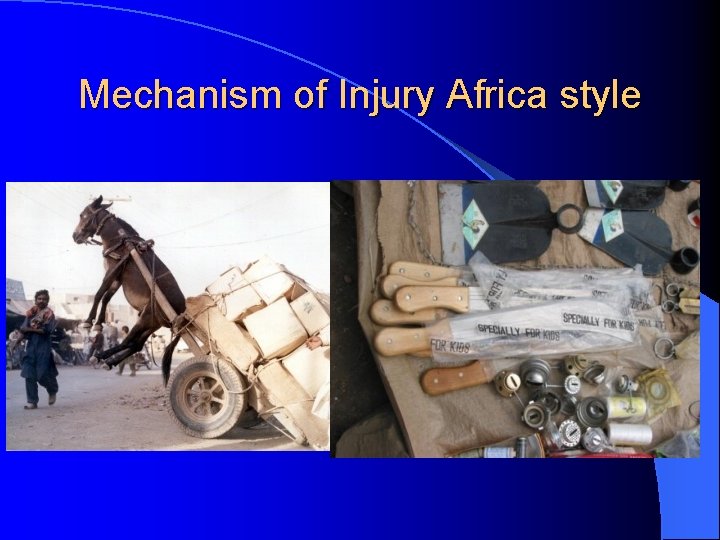 Mechanism of Injury Africa style Mechanism of Injury Africa style