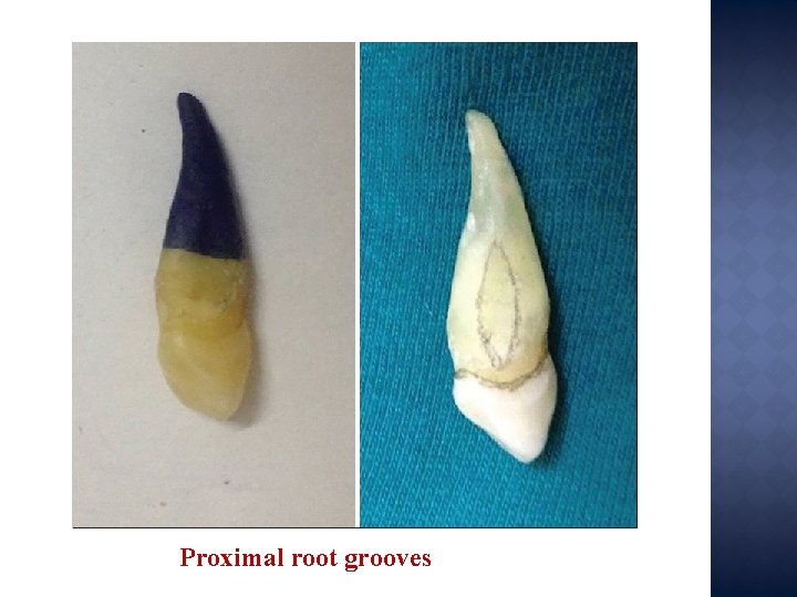 Proximal root grooves 