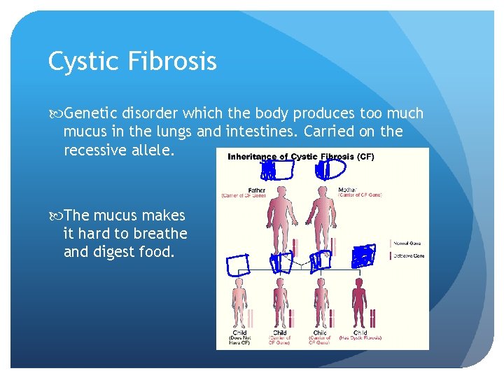 Cystic Fibrosis Genetic disorder which the body produces too much mucus in the lungs