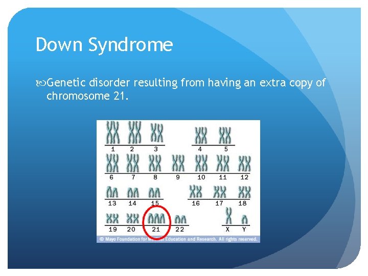 Down Syndrome Genetic disorder resulting from having an extra copy of chromosome 21. 