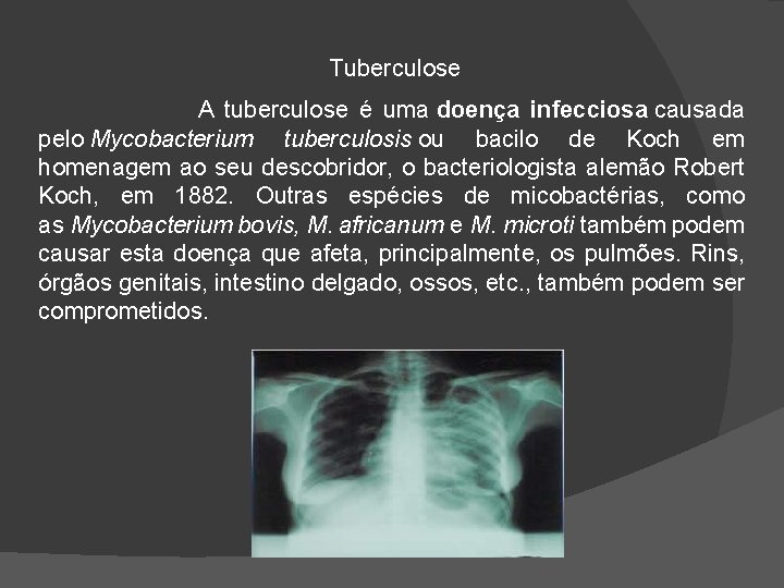 Tuberculose A tuberculose é uma doença infecciosa causada pelo Mycobacterium tuberculosis ou bacilo de