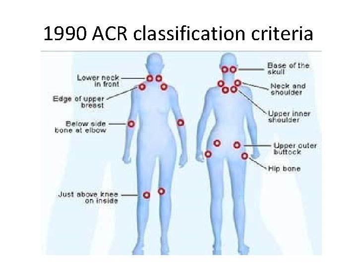 1990 ACR classification criteria 