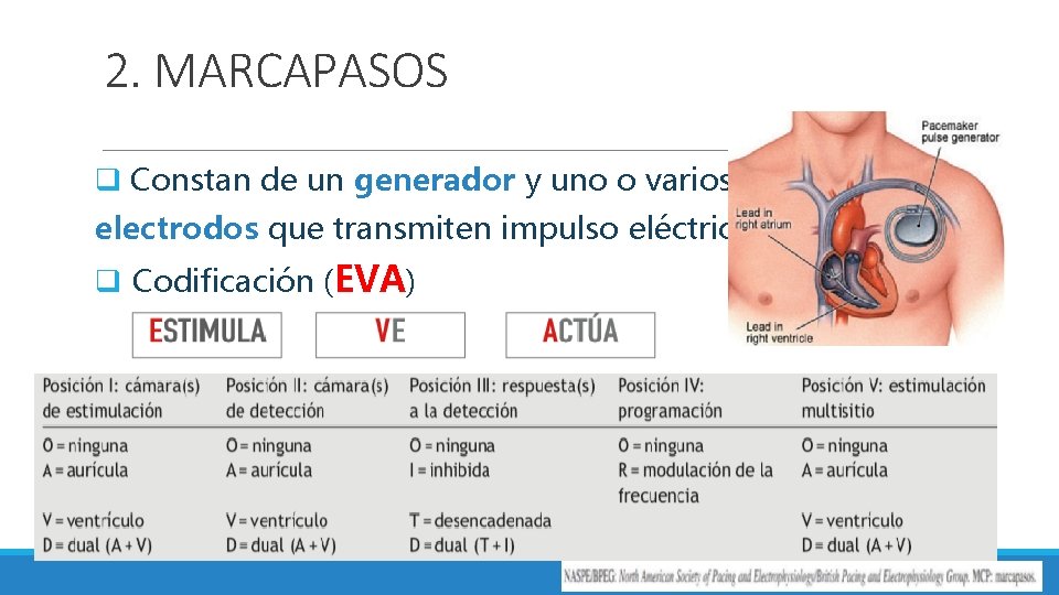 2. MARCAPASOS q Constan de un generador y uno o varios electrodos que transmiten