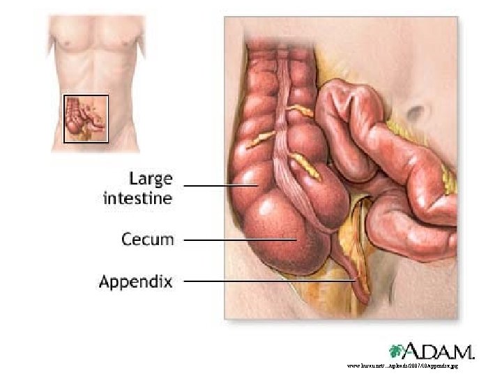 Appendix www. kucau. net/. . . /uploads/2007/10/appendix. jpg 