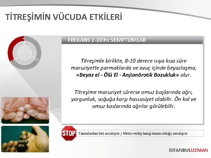 TİTREŞİMİN VÜCUDA ETKİLERİ FREKANS 2 -30 Hz SEMPTOMLAR Titreşimle birlikte, 8 -10 derece ısıya