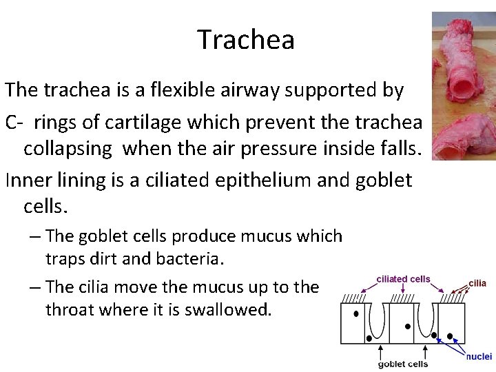 Trachea The trachea is a flexible airway supported by C- rings of cartilage which