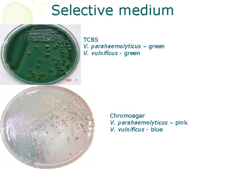 Selective medium TCBS V. parahaemolyticus – green V. vulnificus - green Chromoagar V. parahaemolyticus Selective medium TCBS V. parahaemolyticus – green V. vulnificus - green Chromoagar V. parahaemolyticus
