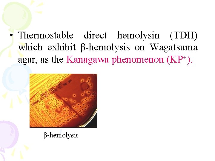 • Thermostable direct hemolysin (TDH) which exhibit β-hemolysis on Wagatsuma agar, as the • Thermostable direct hemolysin (TDH) which exhibit β-hemolysis on Wagatsuma agar, as the