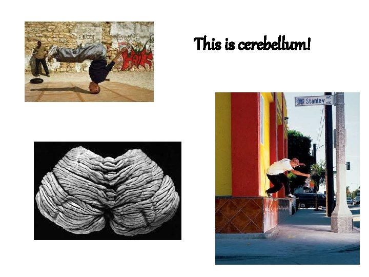 This is cerebellum! 