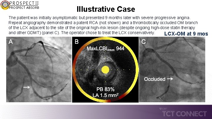 PROSPECT II PROSPECT ABSORB Illustrative Case The patient was initially asymptomatic but presented 9