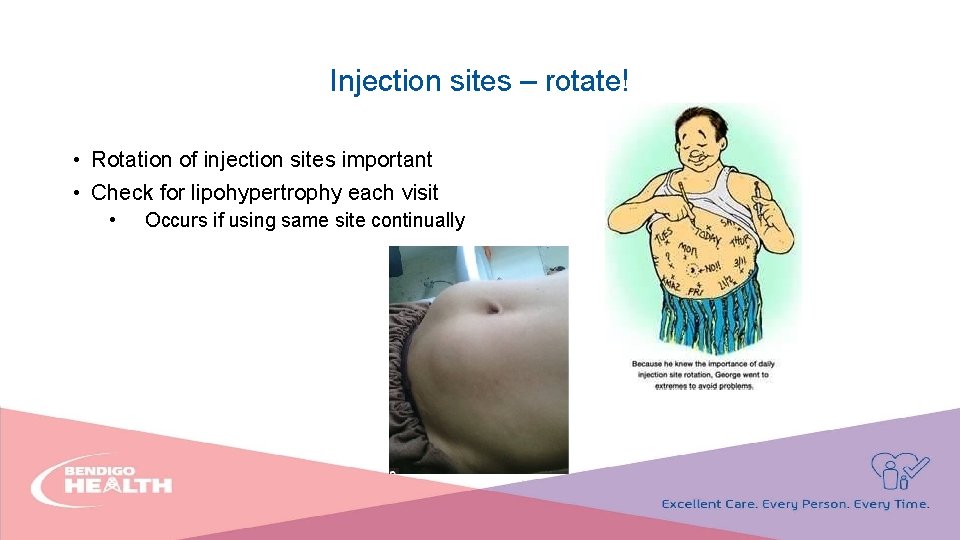 Injection sites – rotate! • Rotation of injection sites important • Check for lipohypertrophy