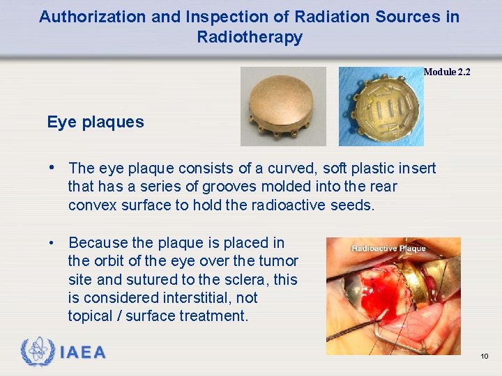 Authorization and Inspection of Radiation Sources in Radiotherapy Module 2. 2 Eye plaques •