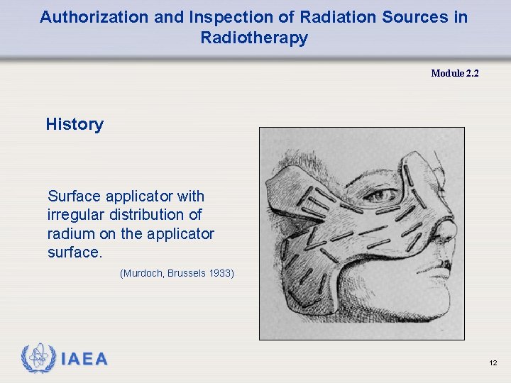 Authorization and Inspection of Radiation Sources in Radiotherapy Module 2. 2 History Surface applicator