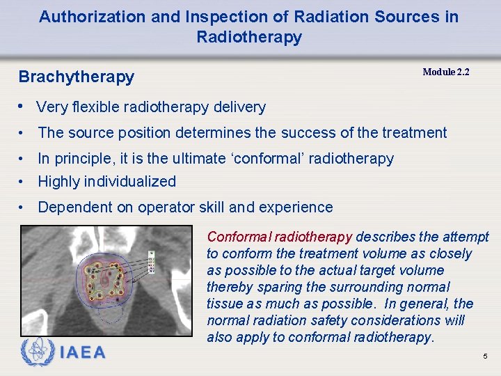 Authorization and Inspection of Radiation Sources in Radiotherapy Module 2. 2 Brachytherapy • Very