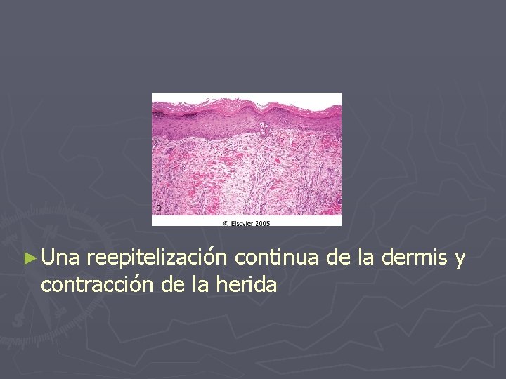 ► Una reepitelización continua de la dermis y contracción de la herida 