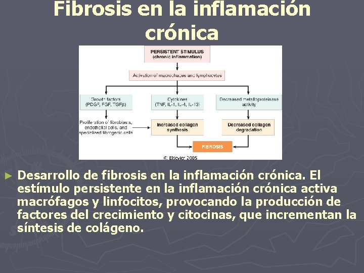 Fibrosis en la inflamación crónica ► Desarrollo de fibrosis en la inflamación crónica. El