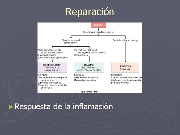 Reparación ► Respuesta de la inflamación 