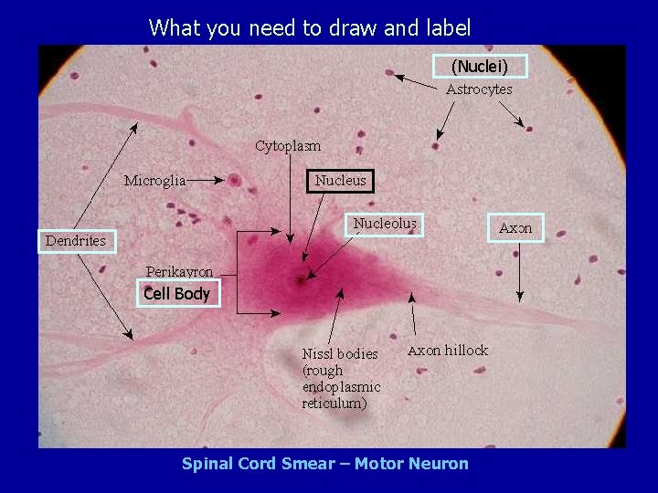What you need to draw and label (Nuclei) Cell Body Spinal Cord Smear –
