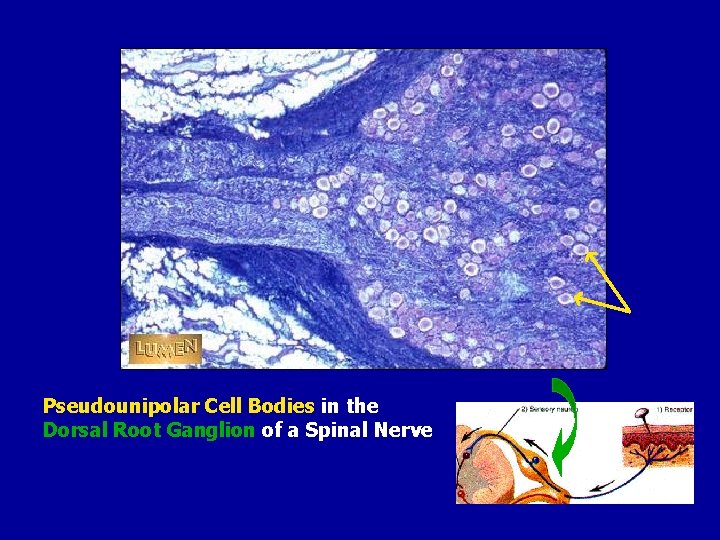Pseudounipolar Cell Bodies in the Dorsal Root Ganglion of a Spinal Nerve 