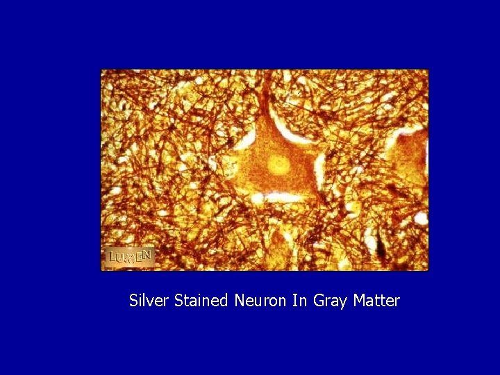 Silver Stained Neuron In Gray Matter 