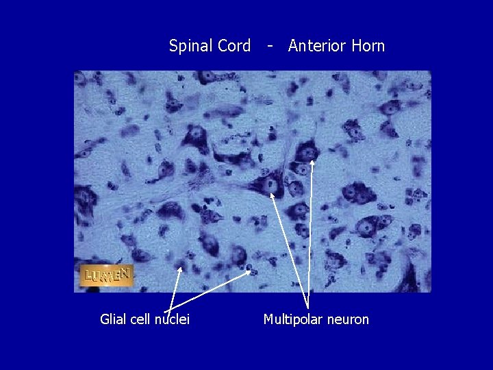 Spinal Cord - Anterior Horn Glial cell nuclei Multipolar neuron 