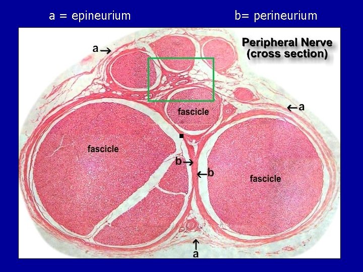 a = epineurium b= perineurium 