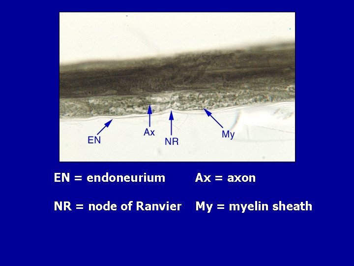 EN = endoneurium Ax = axon NR = node of Ranvier My = myelin