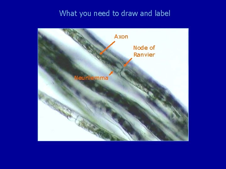 What you need to draw and label Axon Node of Ranvier Neurilemma 