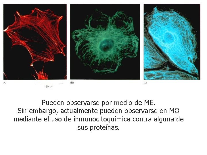 Pueden observarse por medio de ME. Sin embargo, actualmente pueden observarse en MO mediante