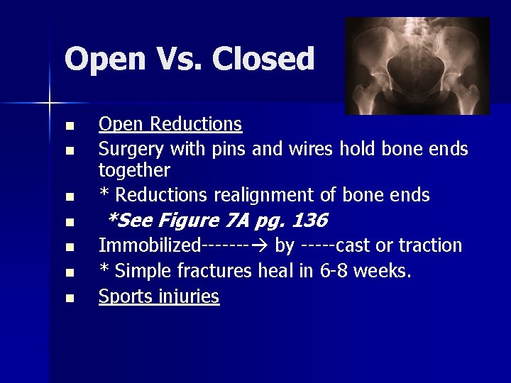 Open Vs. Closed n n n n Open Reductions Surgery with pins and wires