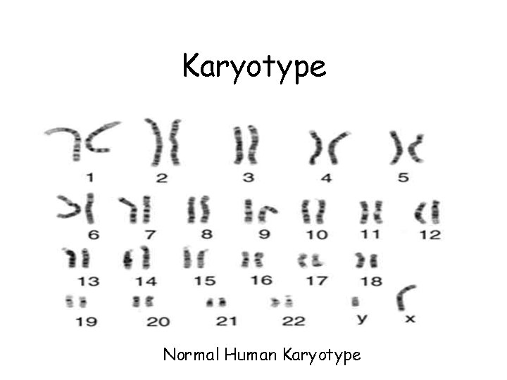 Karyotype Normal Human Karyotype Karyotype Normal Human Karyotype
