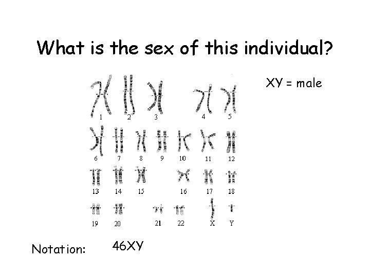 What is the sex of this individual? XY = male Notation: 46 XY What is the sex of this individual? XY = male Notation: 46 XY
